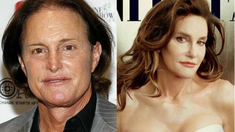 Após uma cirurgia de 10 horas, Caitlyn se despediu de Bruce