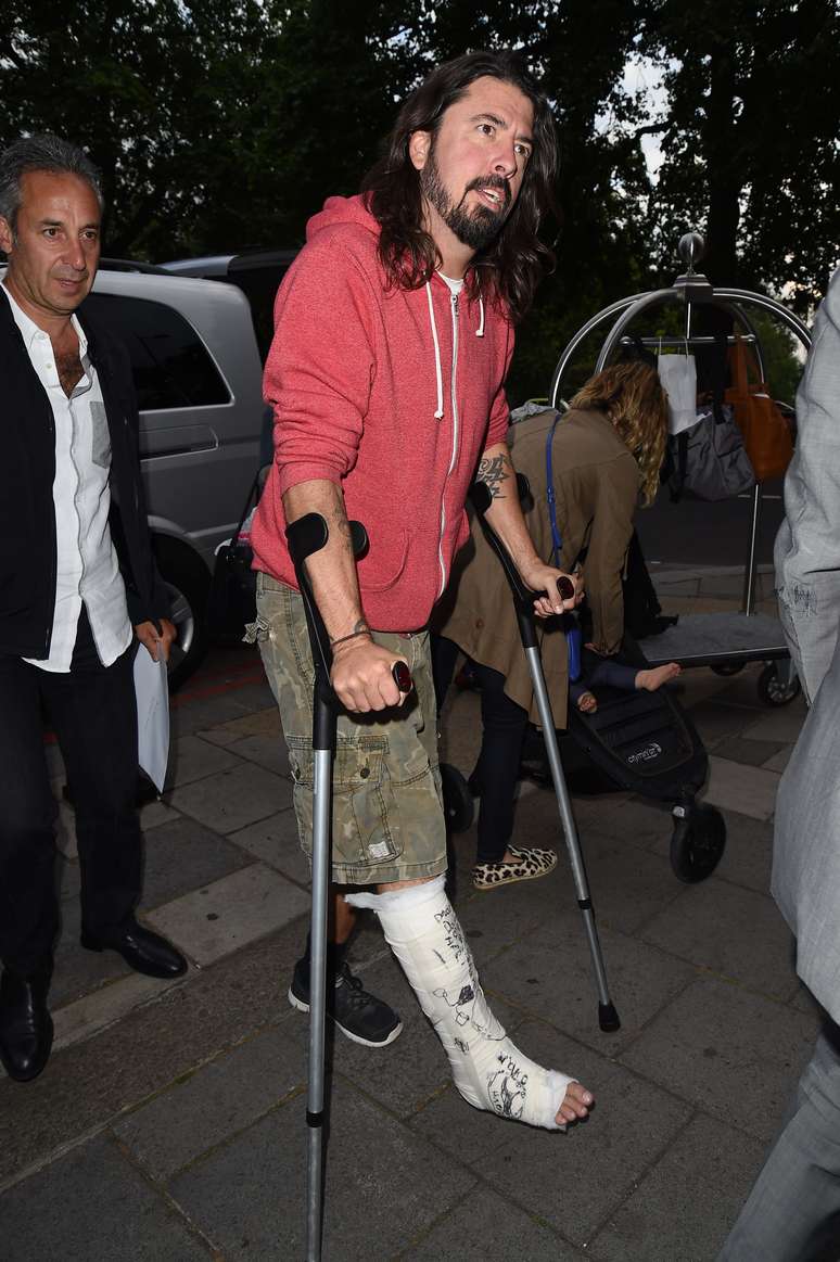 Vocalista do Foo Fighters Dave Grohl com gesso na perna após acidente no palco