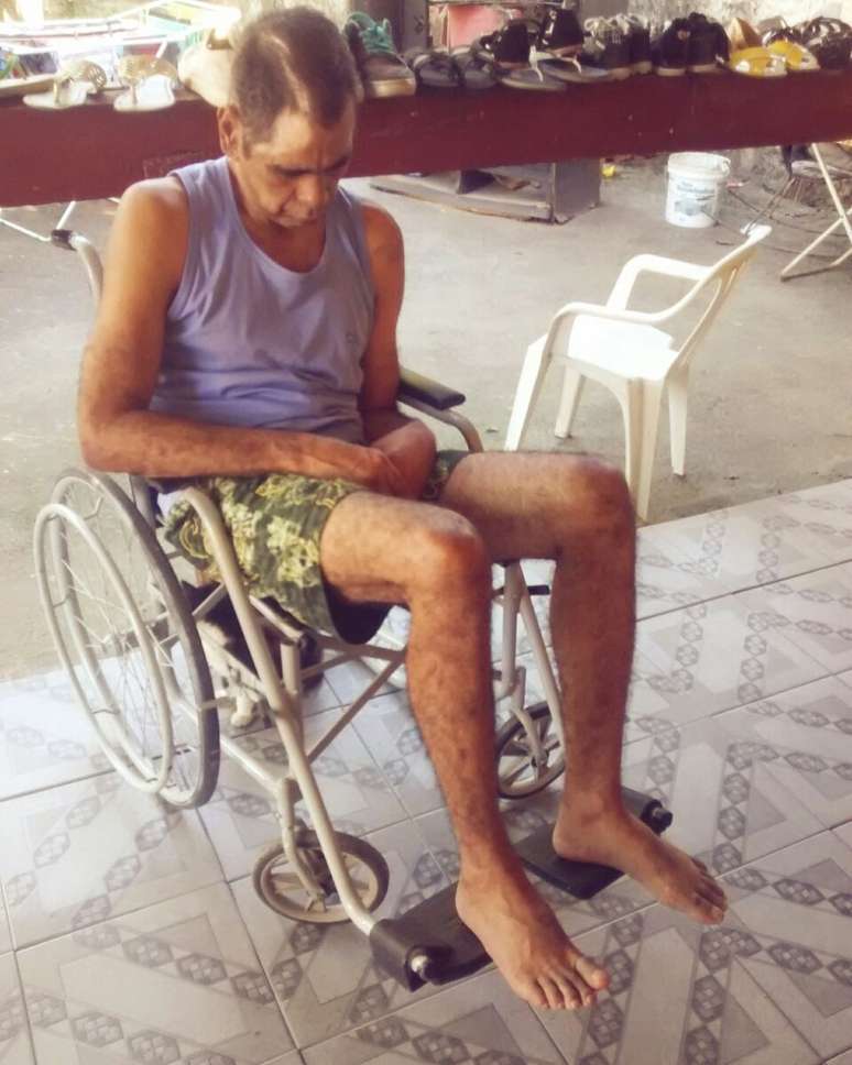 Filho do paciente afirmou que o pai est&aacute; perdendo os movimentos do corpo