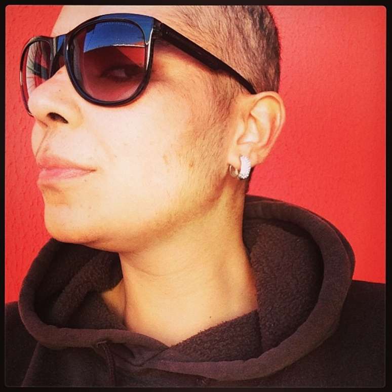 Camila Correa recebeu o diagnóstico de alopecia areata em 2010 e, no ano seguinte, perdeu todos os fios de cabelo