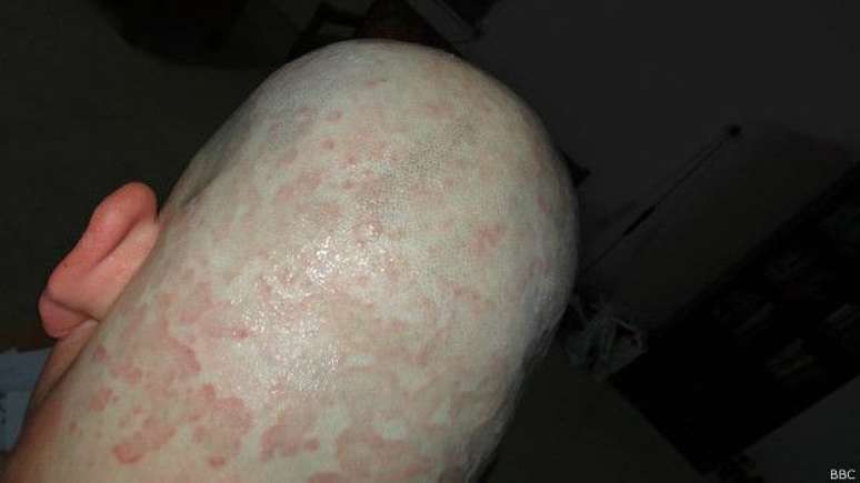 Ele &eacute; iraquiano e gay. E sobreviveu &agrave; persegui&ccedil;&atilde;o do EI