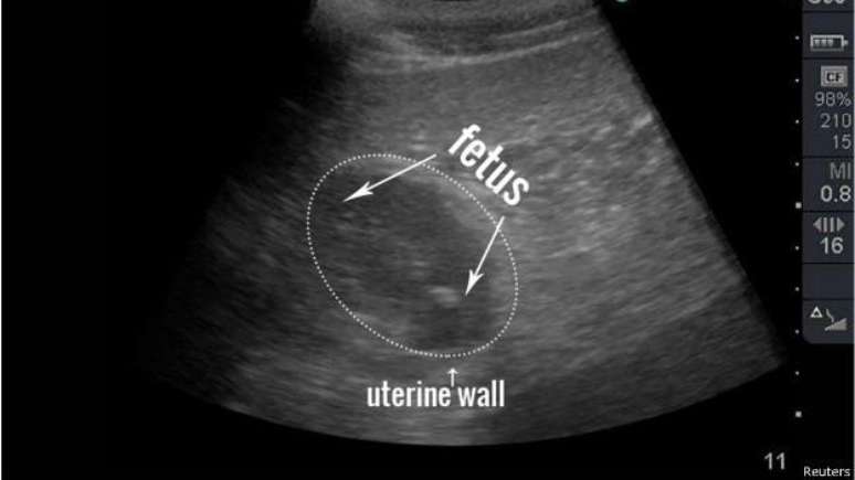 Funcionários descobriram que panda estava grávida durante exame de ultrassom na semana passada