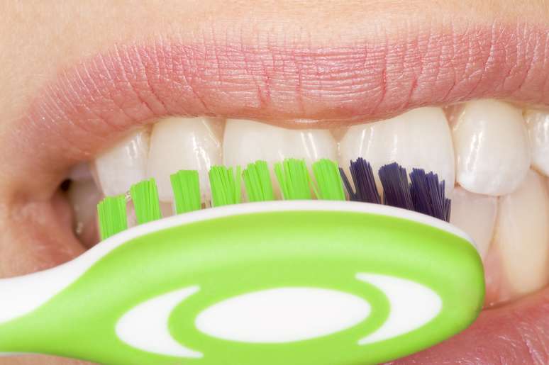 A escova deve ser apoiada suavemente sobre a superfície dos dentes em um ângulo de 45 graus, com a metade das cerdas recobrindo a superfície dental e a outra metade envolvendo a gengiva