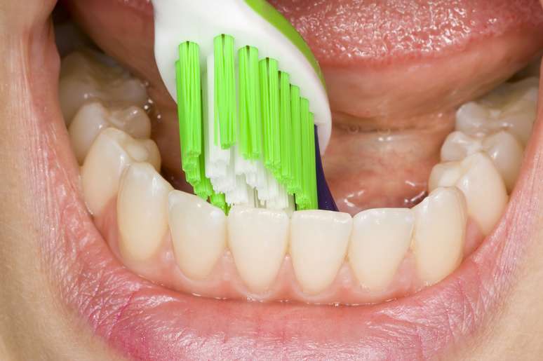 Escove a face voltada para a bochecha e a face interna dos dentes, e a superfície usada para mastigar com movimentos de vai e vem