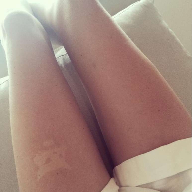 Mulher exibe "tatuagem" na coxa, adquirida por meio da Sunburn Art