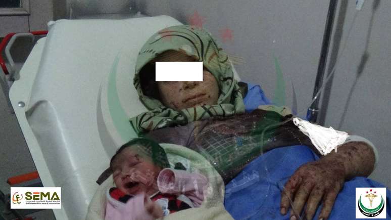 A mãe da criança foi atingida em um bombardeio na Síria