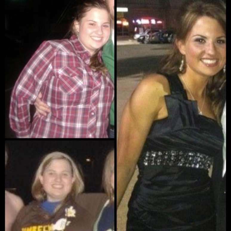 Christine antes de começar a emagrecer e depois de perder 44kg quando sofria de Orthorexia