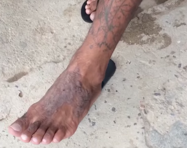 Doen&ccedil;as de pele s&atilde;o comuns entre internos