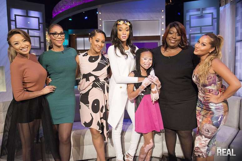 April conheceu a modelo Winnie Harlow, que tamb&eacute;m tem vitiligo