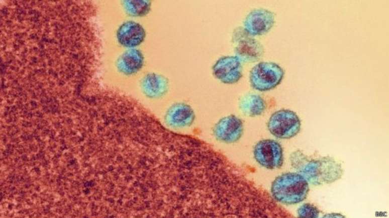 Tratamento anti-retroviral impede v&iacute;rus de se multiplicar e reduz a quantidade dele no corpo