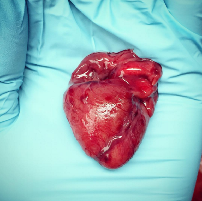 Nicole mostra o coração de um feto; órgão cabia na palma de sua mão
