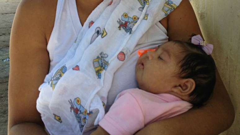 Vans de prefeituras do interior de Pernambuco levam mães e bebês com microcefalia para Recife