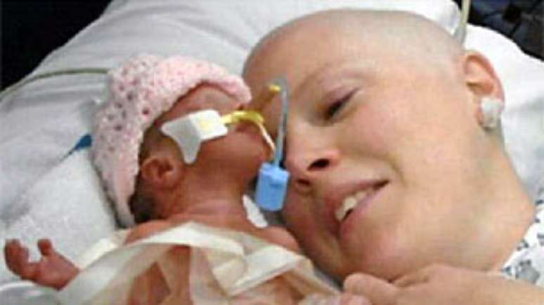 Ally Louise Smith est&aacute; na unidade neonatal e deve voltar para casa apenas em mar&ccedil;o (Foto: BBC)