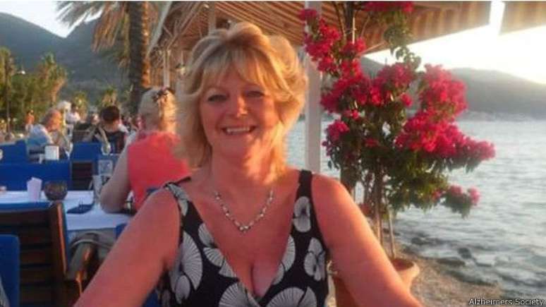 Dianne Wilkinson foi diagnosticada com Alzheimer aos 57 anos de idade