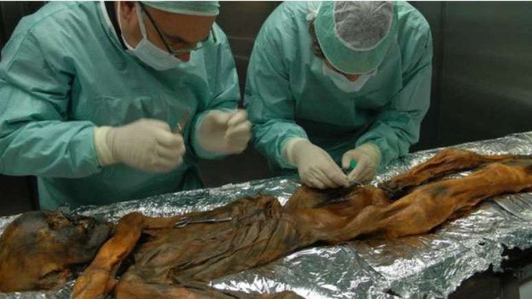 Cadáver congelado de Ötzi permitiu aos cientistas voltar no tempo em um nível de detalhado e inédito 