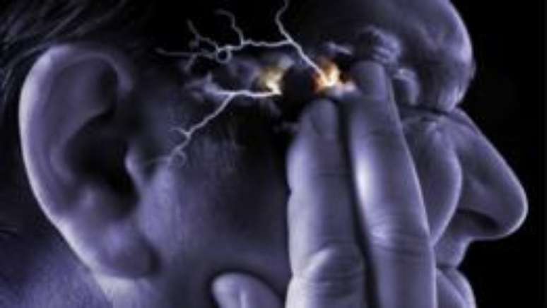 Pessoas que sofrem da s&iacute;ndrome costumam ter tamb&eacute;m enxaquecas