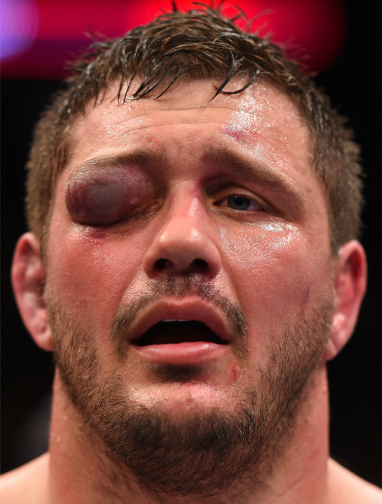 Matt Mitrione foi derrotado no UFC Boston por Travis Browne