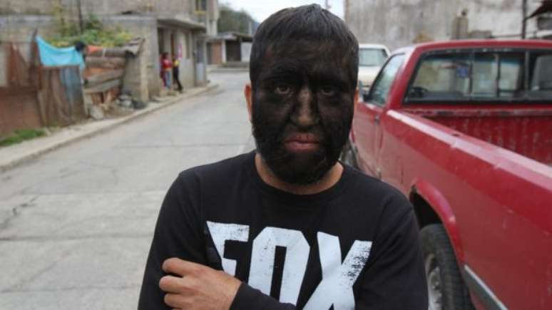 Jesus 'Chuy' Aceves foi muito mal tratado, abandonou os shows e hoje trabalha em um dep&oacute;sito de lixo (Foto: BBC)