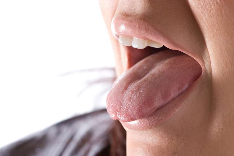 A saburra lingual é uma camada esbranquiçada ou amarelada que fica sobre a nossa língua, bem lá no fundo perto da garganta