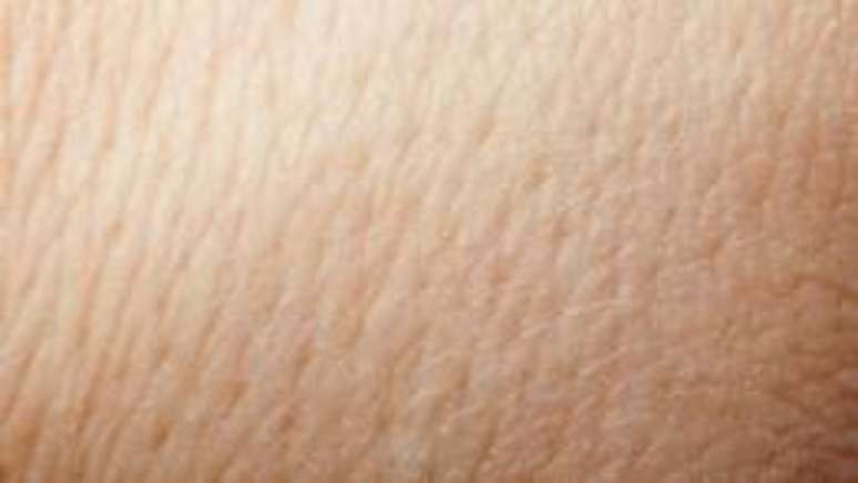 O LSS pode reduzir resist&ecirc;ncia a alerg&ecirc;nicos
