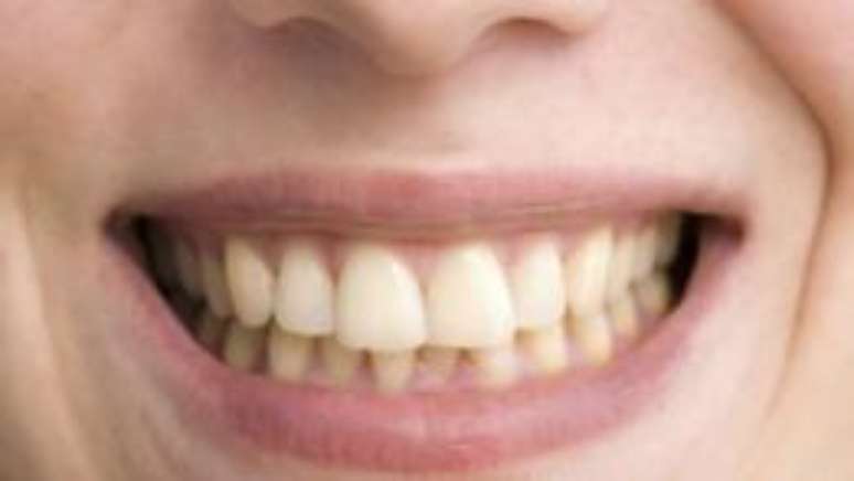 Humanos t&ecirc;m mesmo tipo de c&eacute;lula, mas elas desaparecem ap&oacute;s crescimento de dentes definitivos