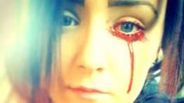 A jovem convive com os sangramentos desde os 14 anos