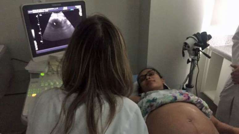 Obstetra defende que se passe a falar em “síndrome da Zika congênita"