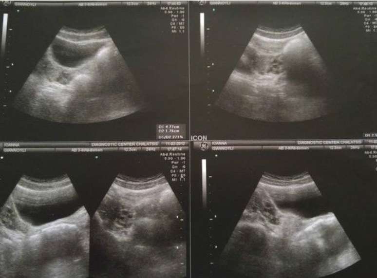 Ultrassonografia feita do ventre de Joanna, em 2013