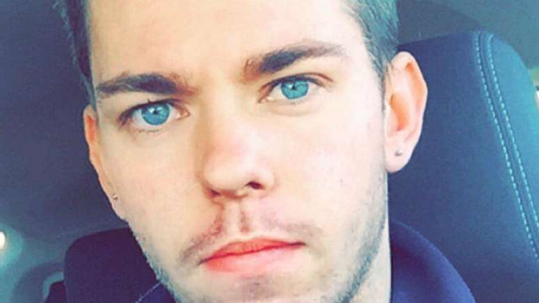 Quando Jordan tinha acne, alguns colegas diziam a ele para beber mais &aacute;gua.