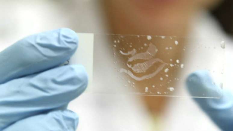 Cientistas do Instituto D'Or observam ataques do vírus a "minicérebros"