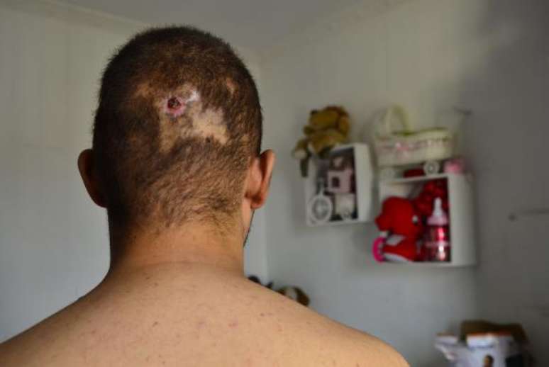 O adolescente Luís* levou um tiro nas costas e na cabeça após perseguição policial