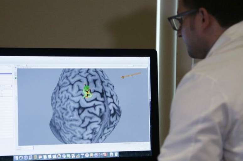 Pesquisas feitas nas últimas décadas revolucionaram conhecimento sobre cérebro