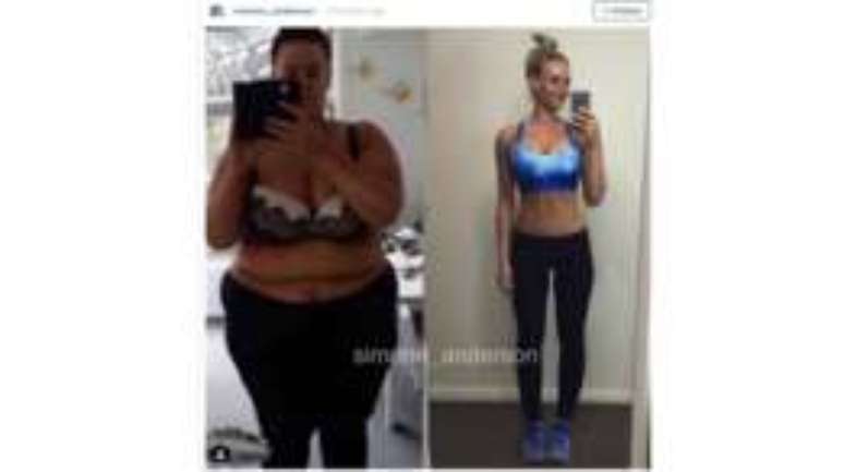 'Semana 88. Atualiza&ccedil;&atilde;o. De 169 kg para 77 kg - uma perda total de 92 kg. Tenho 1,81 m. Para os que est&atilde;o vendo minha jornada pela primeira vez, isso aconteceu em apenas um ano e oito meses. Comecei minha jornada em 29 de agosto de 2014 e fiz uma cirurgia g&aacute;strica no dia 29 de outubro de 2014 - mudei completamente meu estilo de vida, dieta e exerc&iacute;cios. H&aacute; tr&ecirc;s semanas fiz minha abdominoplastia, (...) levantamento e aumento dos seios (ent&atilde;o, basicamente, a maior parte da minha pele em excesso foi removida, exceto a pele da parte superior das coxas e das n&aacute;degas)', escreveu a neozelandesa