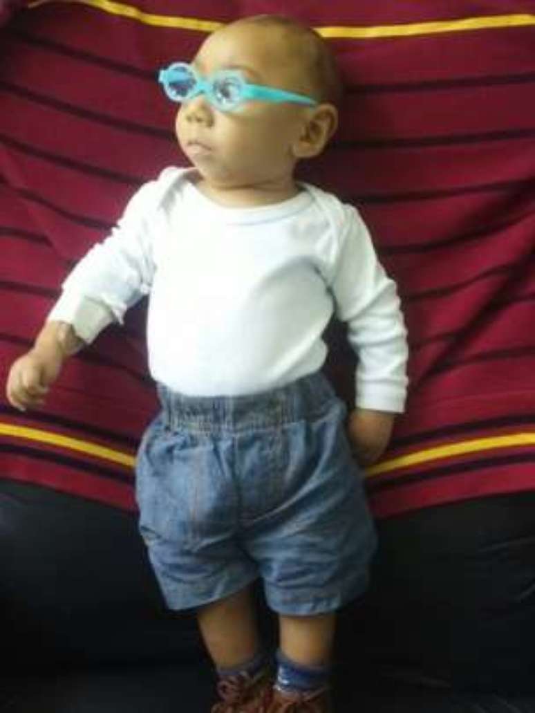 Aos oito meses, Jos&eacute; Wesley j&aacute; usa &oacute;culos e faz sess&otilde;es de fisioterapia regulares