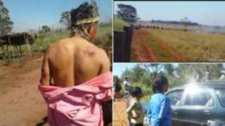 Imagens do conflito na fazenda Ivu, em Caarapó (MS): índio ferido, momento do ataque dos fazendeiros e guarani-kaiowá levando um ferido ao hospital