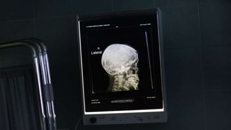 Segundo especialistas do projeto TENDR, certos produtos qu&iacute;micos afetam o desenvolvimento mental 