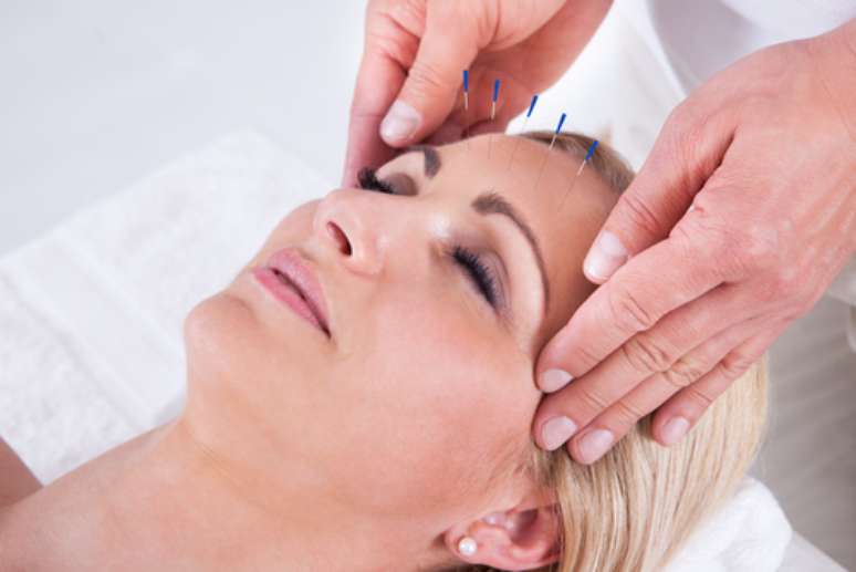 A acupuntura pode ser utilizada em todas as especialidades odontológicas como terapia complementar
