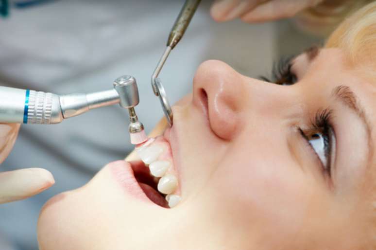 Através do procedimento de profilaxia dental (polimento dental) o dentista consegue remover as manchas e devolver ao paciente um sorriso agradável