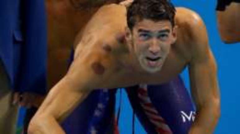 O nadador norte-americano Michael Phelps, vencedor de 19 medalhas de ouro, com marcas nos ombros e nas costas