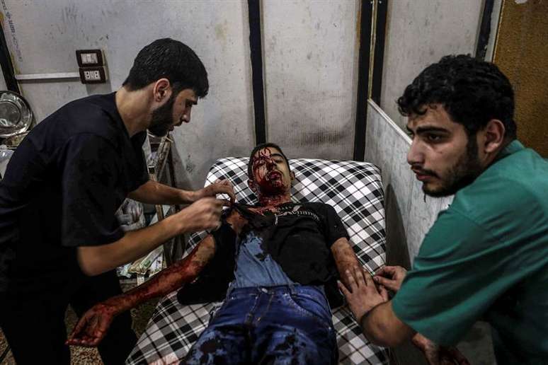 Jovem sírio recebe atendimento médico após bombardeio