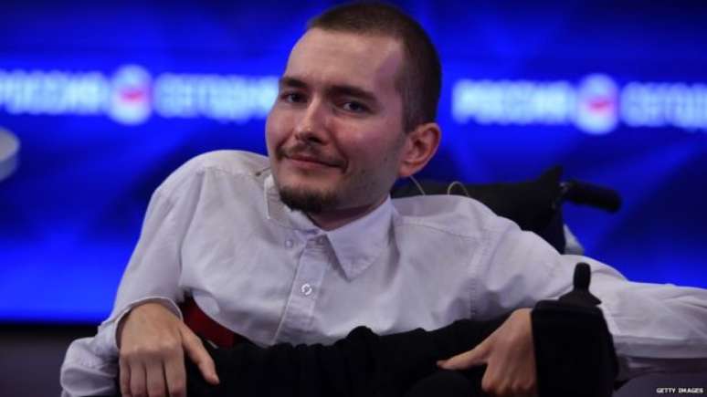 O russo Valery Spiridonov, de 31 anos, quer se submeter à cirurgia