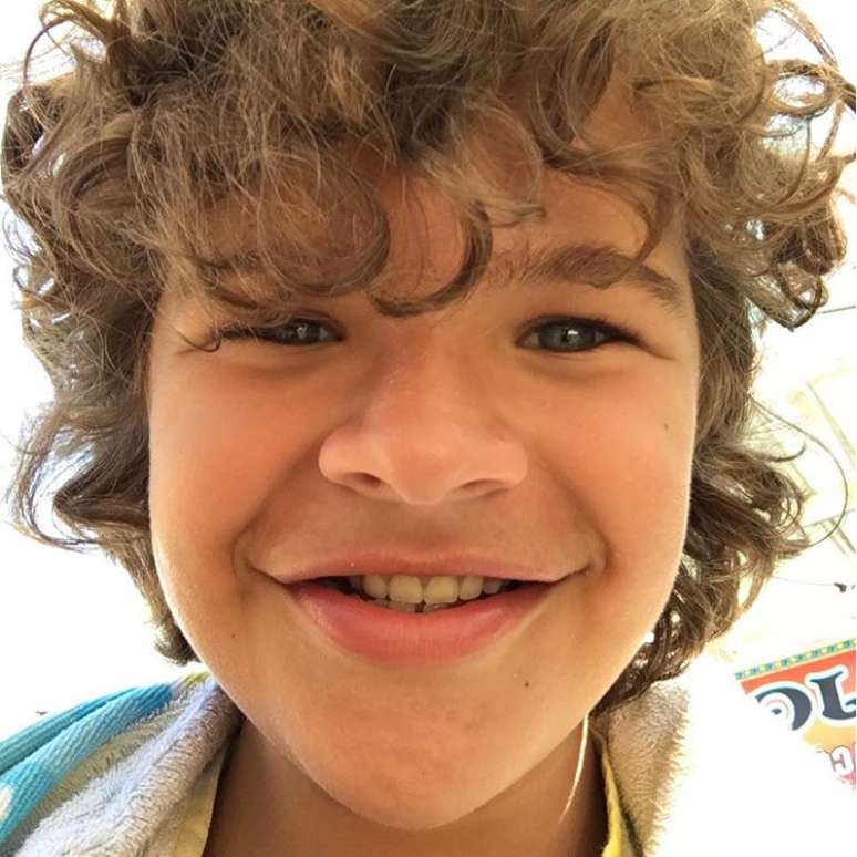 Alias, Gaten já anda desfilando por aí com um sorriso cheio de dentes, e os jornais americanos afirmam que esse ano o ator fez sua primeira cirurgia para consertar o problema