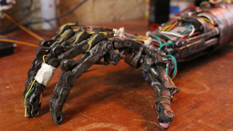 Pr&oacute;teses foram feitas com pe&ccedil;as descart&aacute;veis e partes de utens&iacute;lios dom&eacute;sticos 