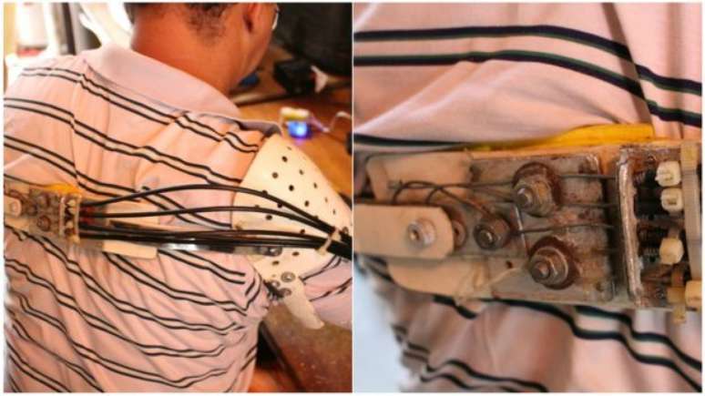 Em pr&oacute;tese de Ari, cada fio de ferro se conecta com el&aacute;sticos que movimentam cada dedo, numa ponta da pr&oacute;tese. Na outra, os ferros ficam ligados &agrave; estrutura que se prende ao ombro oposto. Quando ele movimenta o ombro, puxa os ferros e os el&aacute;sticos e, ent&atilde;o, movimenta os dedos. 