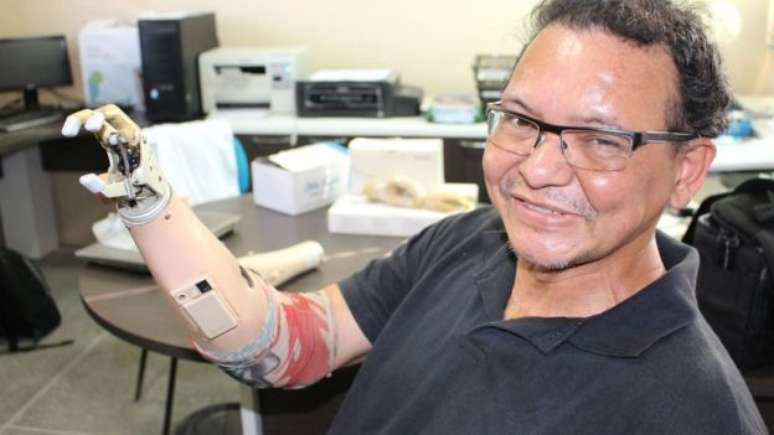 Ari Ribeiro com pr&oacute;tese de R$ 30 mil que ganhou de empresa; ele continua usando suas inven&ccedil;&otilde;es, pois pr&oacute;tese tem apenas tr&ecirc;s dedos e n&atilde;o possui mobilidade no punho, algo que sua inven&ccedil;&atilde;o de R$ 400 oferece 