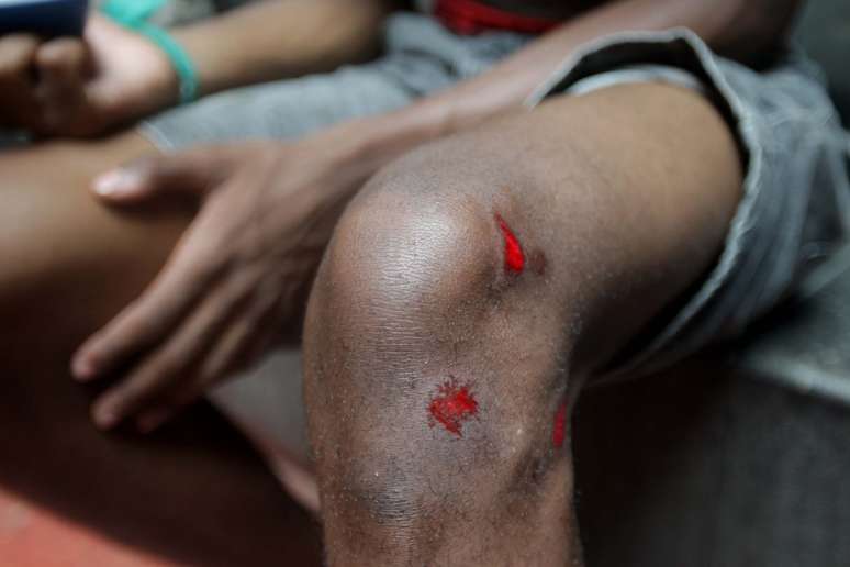 Estudantes reclamam de truculência da PM com balas de borracha