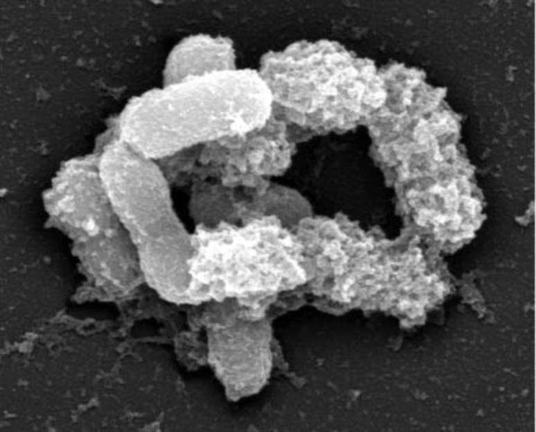 A bactéria Akkermansia muciniphila. Proteína faz parte da membrana externa da bactéria.