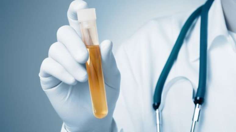 Se a urina est&aacute; muito escura &eacute; sinal de que a pessoa bebe pouco l&iacute;quido; se, por outro lado, estiver quase transparente, estamos bebendo &aacute;gua demais