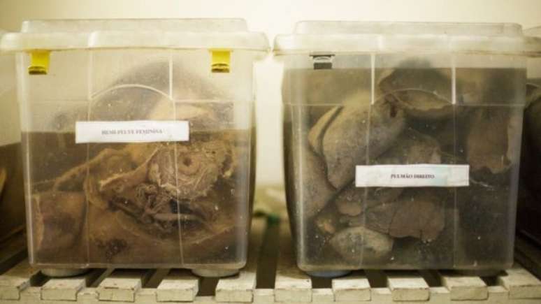 &Oacute;rg&atilde;os preservados para uso em aula; uma vez doado, corpo n&atilde;o pode ser visitado por parentes 