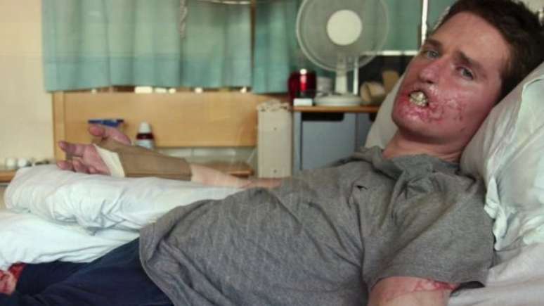 "(A doen&ccedil;a) me fez pensar de forma diferente o que &eacute; ser pai, parceiro, ser humano", disse 